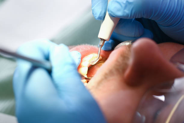 Best Mobile Emergency Dentist in West Carrollton, OH