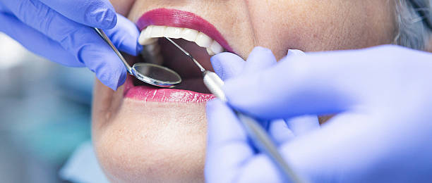 Best Broken or Cracked Tooth Emergency Dentist in West Carrollton, OH